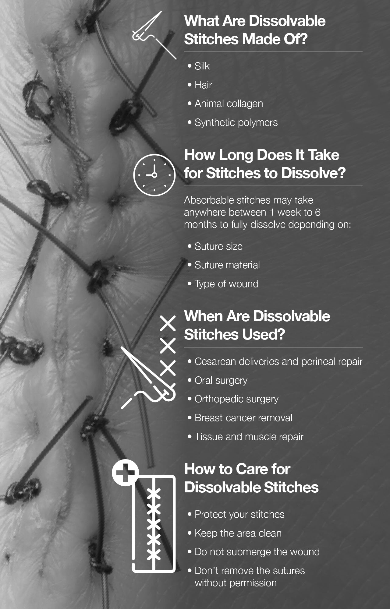 How Long Does It Take for Internal Stitches to Heal in a Dog